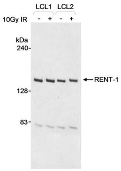 RENT1/UPF1/hUPF1 Antibody, Novus Biologicals 100 &mu;L | Buy Online | Novus Biologicals | Fisher Scientific