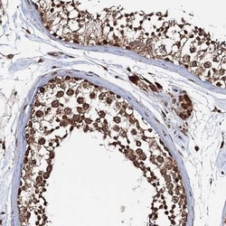 REP15 Antibody, Novus Biologicals 25 &mu;L, Unlabeled:Antibodies, Polyclonal