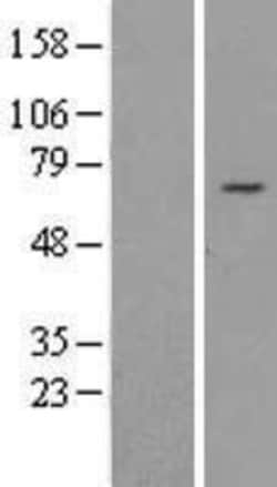 Novus Biologicals&trade;&nbsp;REPIN1 Overexpression Lysate