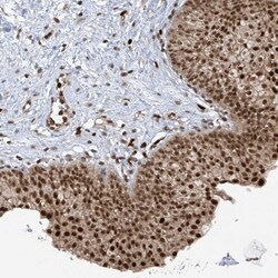 REPIN1 Antibody, Novus Biologicals:Antibodies:Primary Antibodies
