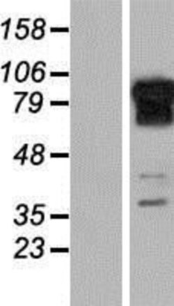 Novus Biologicals&trade;&nbsp;REPS1 Overexpression Lysate