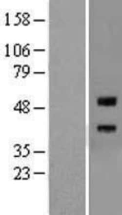 Novus Biologicals&trade;&nbsp;RGM-A Overexpression Lysate