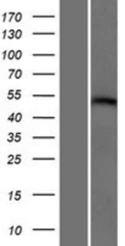 Novus Biologicals&trade;&nbsp;RGM-A Overexpression Lysate