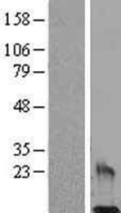 Novus Biologicals™ Resistin Overexpression Lysate