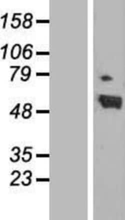 Novus Biologicals&trade;&nbsp;RAR alpha/NR1B1 Overexpression Lysate