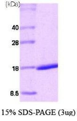 Novus Biologicals&trade;&nbsp;Recombinant Human RAR alpha/NR1B1 His Protein