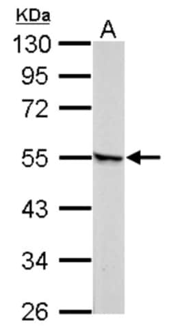 RAR gamma/NR1B3 Antibody, Novus Biologicals 0.1mL; Unlabeled:Antibodies,