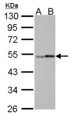 RAR gamma/NR1B3 Antibody, Novus Biologicals 0.1mL; Unlabeled:Antibodies,