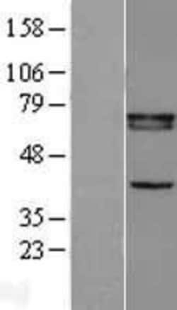 Novus Biologicals&trade;&nbsp;RXR beta/NR2B2 Overexpression Lysate