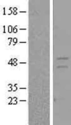 Novus Biologicals&trade;&nbsp;RXR gamma/NR2B3 Overexpression Lysate