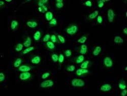 Retinol Binding Protein RBP Antibody (OTI2H3), Novus Biologicals 0.1mL;