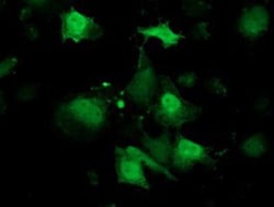 Retinol Binding Protein RBP Antibody (OTI2H3), Novus Biologicals 0.1mL;