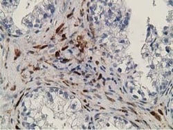 Retinol Binding Protein RBP Antibody (OTI2H3), Novus Biologicals 0.1mL;