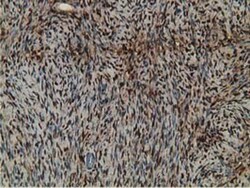 Retinol Binding Protein RBP Antibody (OTI2H3), Novus Biologicals 0.1mL;