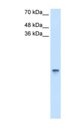 Retinol Binding Protein RBP Antibody, Novus Biologicals:Antibodies:Primary