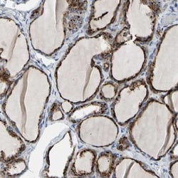 Retinol Saturase Antibody, Novus Biologicals 0.1mL; Unlabeled:Antibodies,