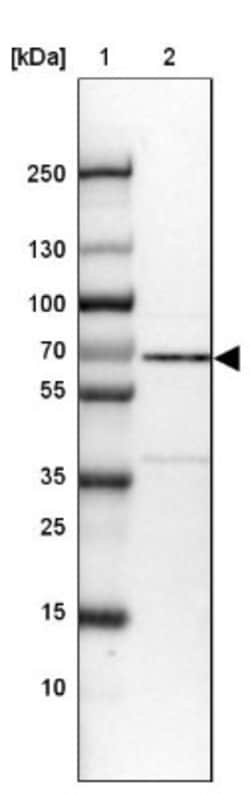 Rev-erb beta/NR1D2 Antibody, Novus Biologicals 0.1mL; Unlabeled:Antibodies,