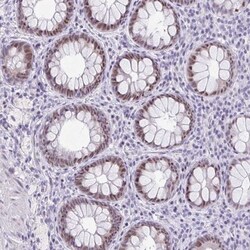 Rev-erb beta/NR1D2 Antibody, Novus Biologicals 0.1mL; Unlabeled:Antibodies,