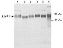Novus Biologicals Reverse Cholesterol Transport Antibody Pack 2 vials:Antibodies