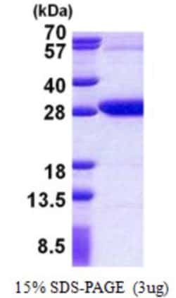 Novus Biologicals&trade;&nbsp;Recombinant Human REXO2 His Protein