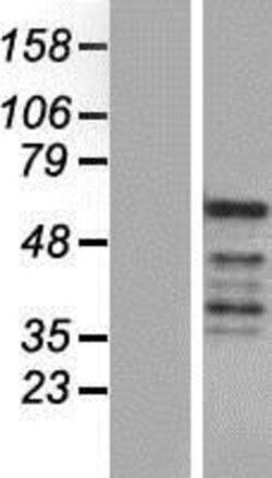 Novus Biologicals&trade;&nbsp;REXO4 Overexpression Lysate