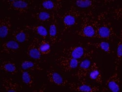 RFC1 Antibody, Novus Biologicals 0.1 mL | Buy Online | Novus Biologicals | Fisher Scientific