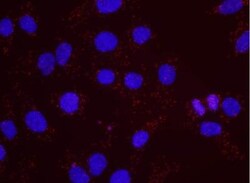 RFC1 Antibody, Novus Biologicals 0.1 mL | Buy Online | Novus Biologicals | Fisher Scientific