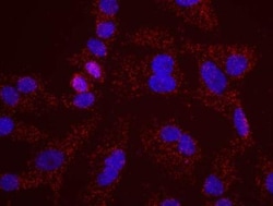 RFC1 Antibody, Novus Biologicals 0.1 mL | Buy Online | Novus Biologicals | Fisher Scientific
