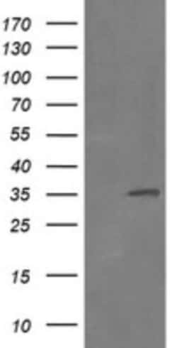 RFC2 Antibody (OTI2B2), Novus Biologicals 0.1 mL | Buy Online | Novus Biologicals | Fisher Scientific
