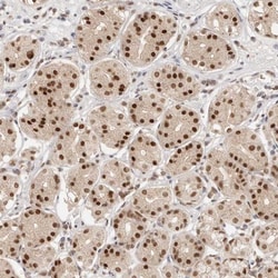 RFC3 Antibody, Novus Biologicals 25 &mu;L | Buy Online | Novus Biologicals | Fisher Scientific