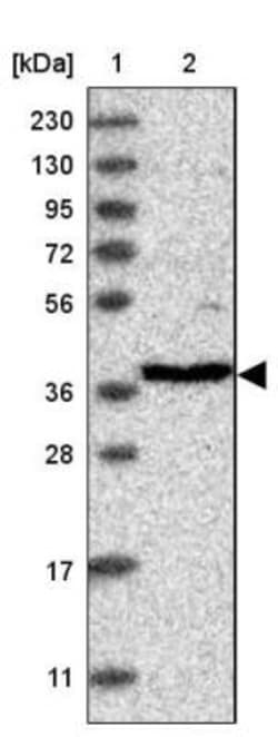 RFC3 Antibody, Novus Biologicals 25 &mu;L | Buy Online | Novus Biologicals | Fisher Scientific