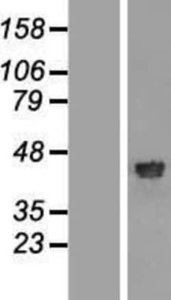Novus Biologicals&trade;&nbsp;RFC4 Overexpression Lysate