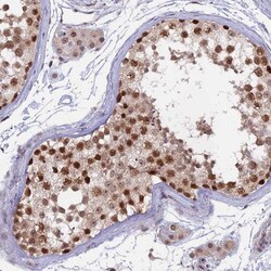 RFC5 Antibody, Novus Biologicals:Antibodies:Primary Antibodies