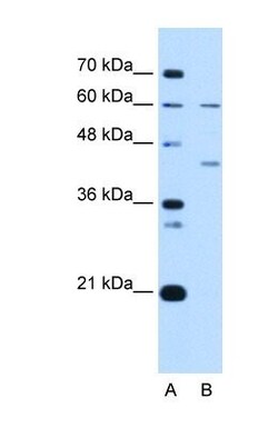 RFC5 Antibody, Novus Biologicals:Antibodies:Primary Antibodies