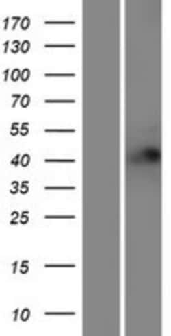 Novus Biologicals™ Rffl Overexpression Lysate