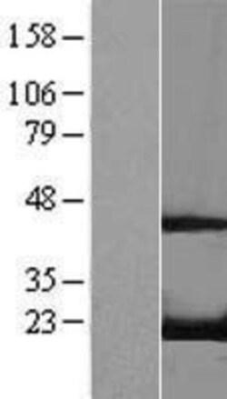 Novus Biologicals&trade;&nbsp;RFK Overexpression Lysate