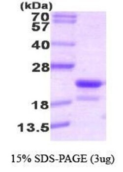Novus Biologicals&trade;&nbsp;Recombinant Human RFK His Protein