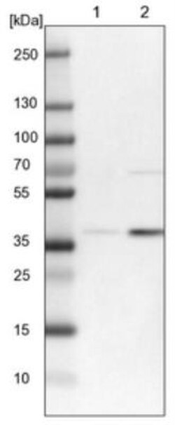 RFNG Antibody, Novus Biologicals:Antibodies:Primary Antibodies