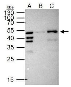 RFP Antibody (1433), Novus Biologicals 0.1mL; Unlabeled:Antibodies, Monoclonal