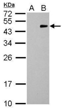 RFP Antibody (1610), Novus Biologicals 0.1mL; Unlabeled:Antibodies, Monoclonal