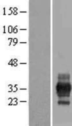 Novus Biologicals&trade;&nbsp;RFPL1 Overexpression Lysate