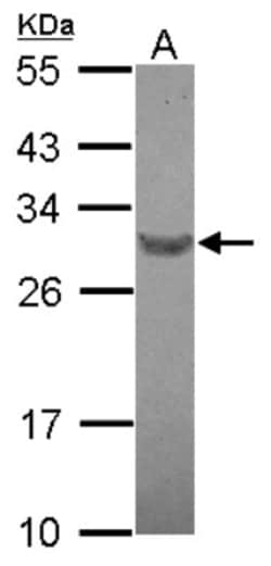 RFPL4B Antibody, Novus Biologicals 0.1mL; Unlabeled:Antibodies, Polyclonal