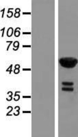 Novus Biologicals&trade;&nbsp;RFTN2 Overexpression Lysate