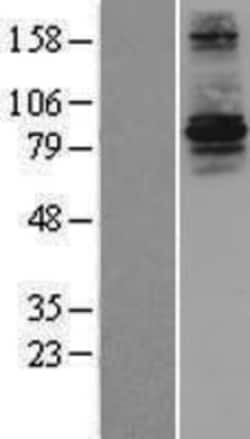 Novus Biologicals&trade;&nbsp;RFWD3 Overexpression Lysate
