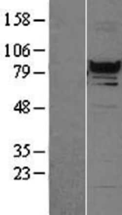 Novus Biologicals&trade;&nbsp;RFX3 Overexpression Lysate
