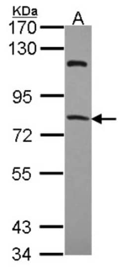 RFX4 Antibody, Novus Biologicals 0.1mL; Unlabeled:Antibodies, Polyclonal