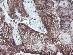 RFXANK Antibody (OTI3E7), Novus Biologicals 0.1mL; Unlabeled:Antibodies,