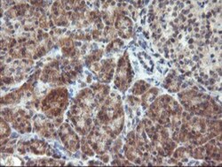 RFXANK Antibody (OTI3E7), Novus Biologicals 0.1mL; Unlabeled:Antibodies,