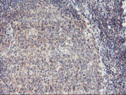 RFXANK Antibody (OTI3E7), Novus Biologicals 0.1mL; Unlabeled:Antibodies,