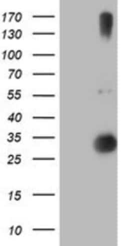 RFXANK Antibody (OTI3E7), Novus Biologicals 0.1mL; Unlabeled:Antibodies,